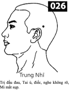 H Trung Nhi